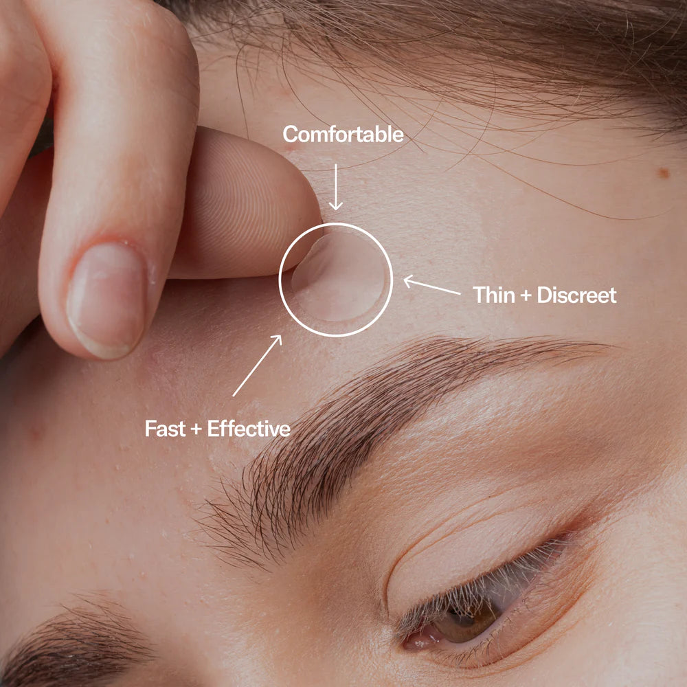 Zit Zappers Pimple Patches