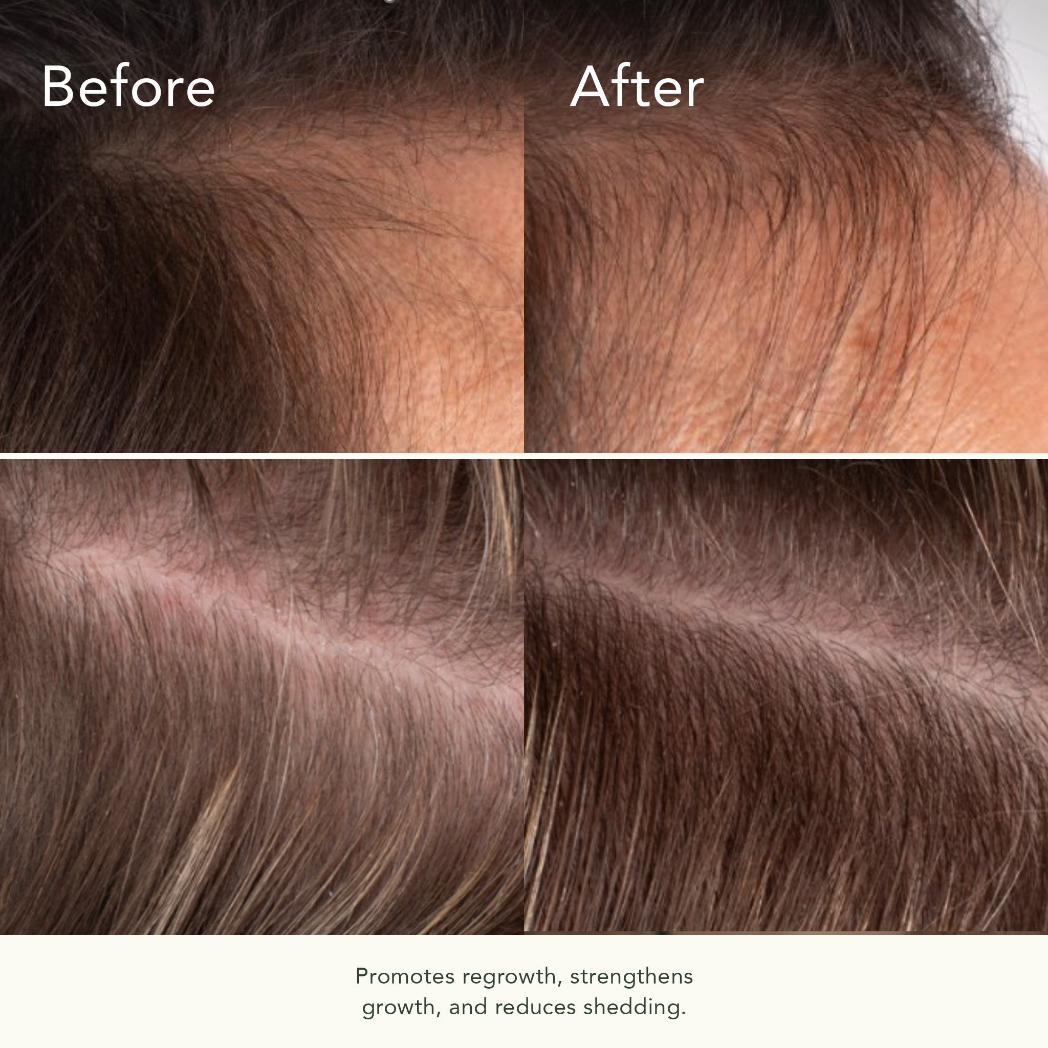 Bio-Ferment Scalp & Hair Treatment