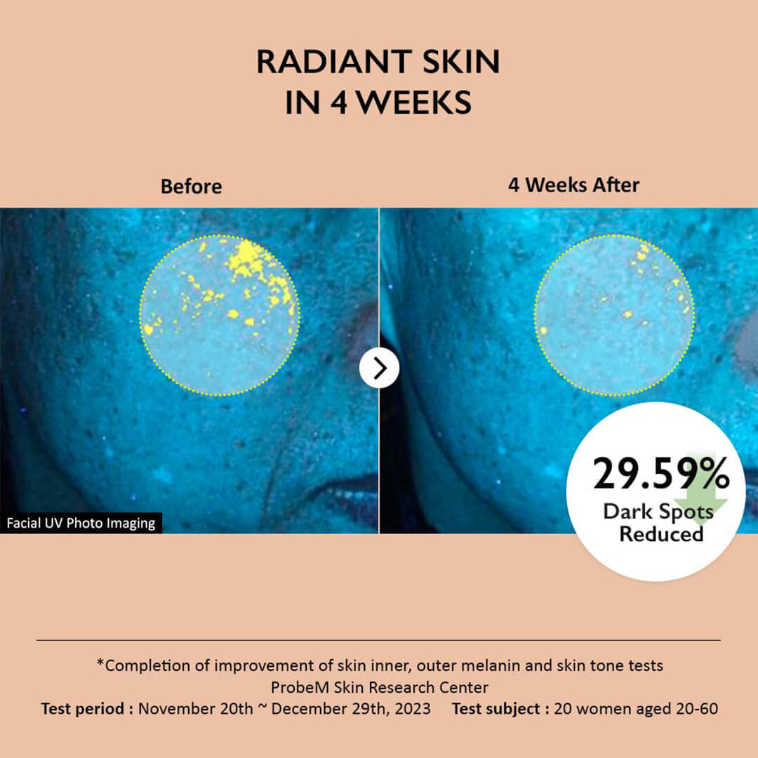 Centella 4% TXA Dark Spot Go Away Serum