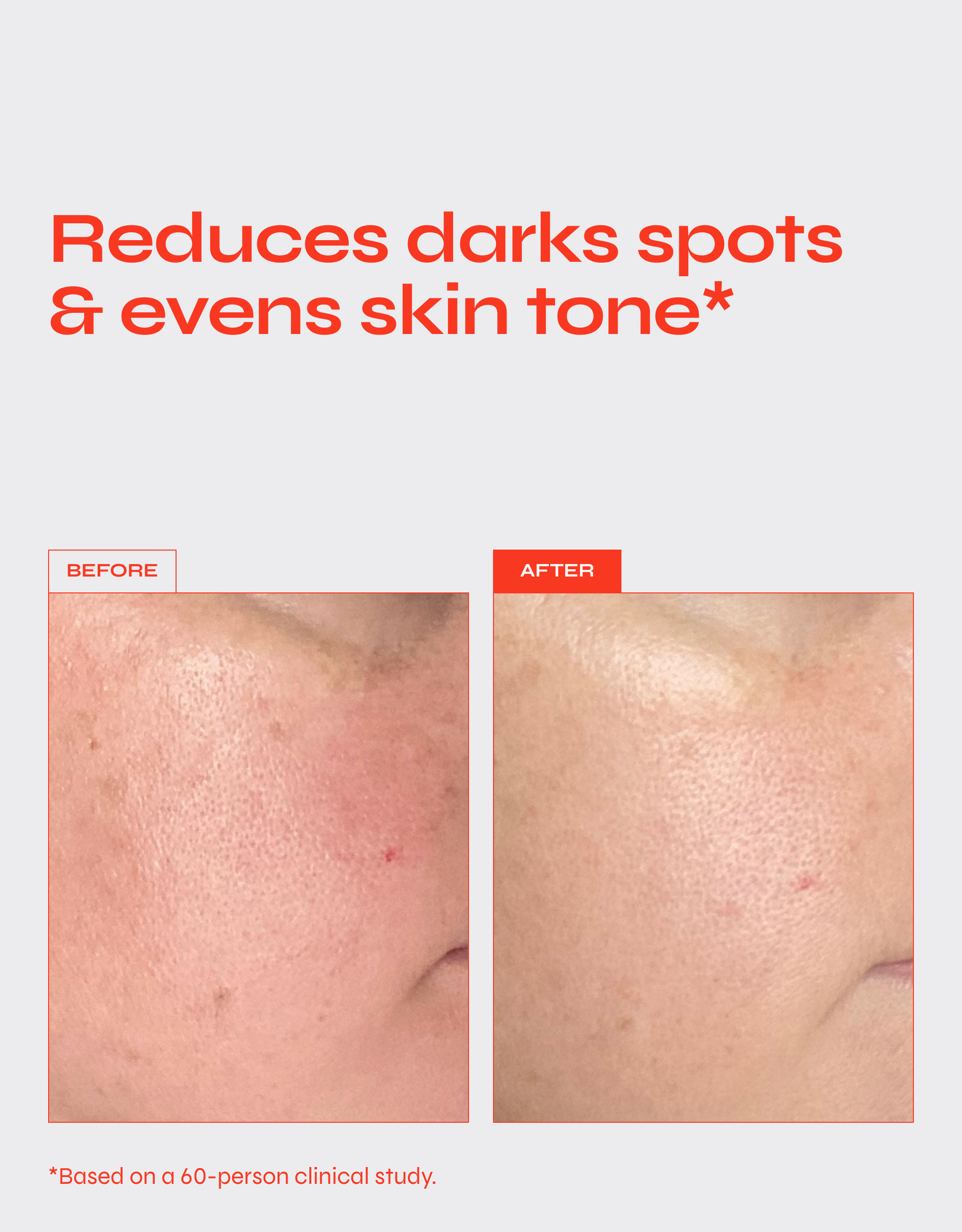 Brighten Serum with Tranexamic Acid and Niacinamide