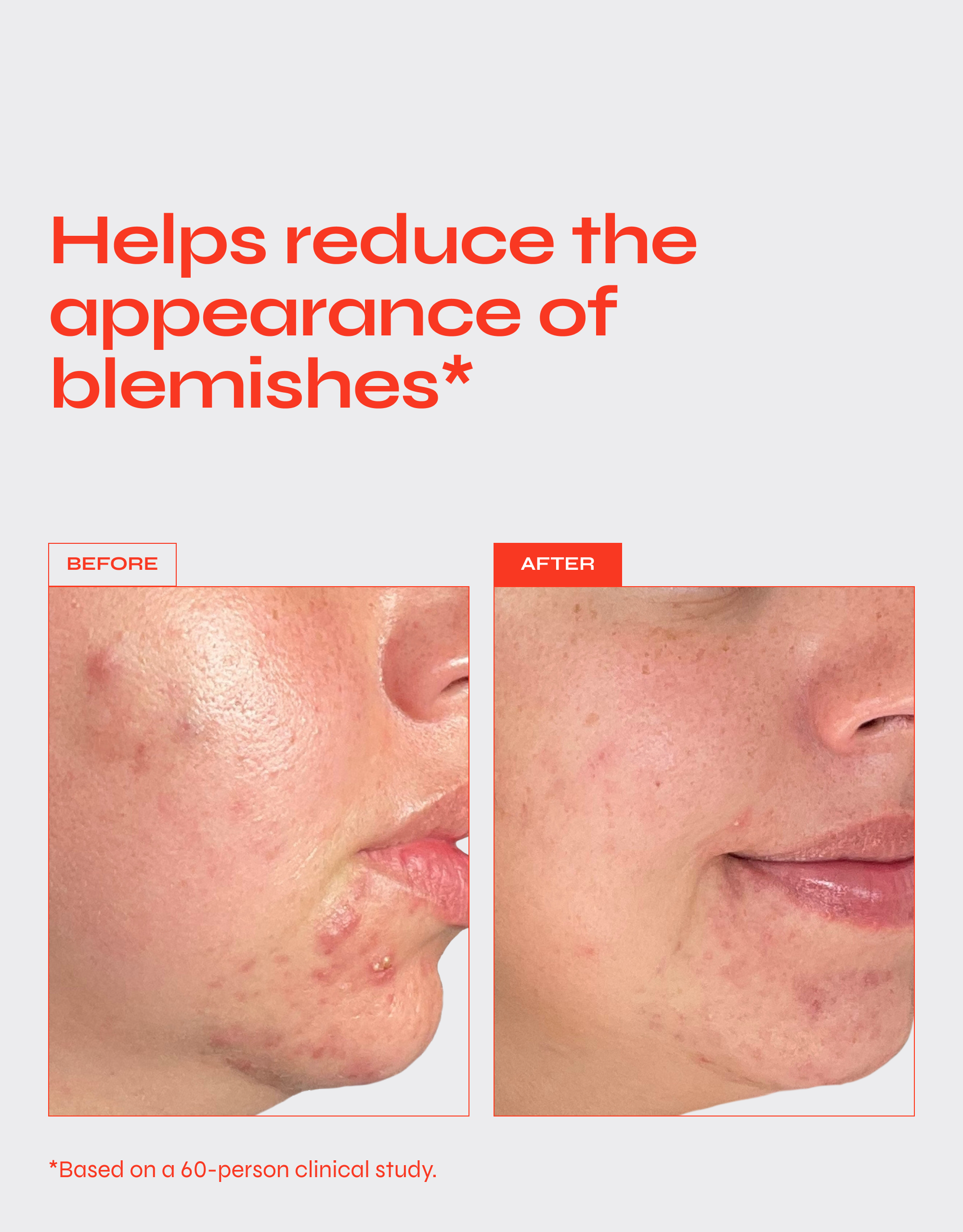 Clear Exfoliating AHA/BHA Serum with Glycolic, Lactic, and Salicylic Acids