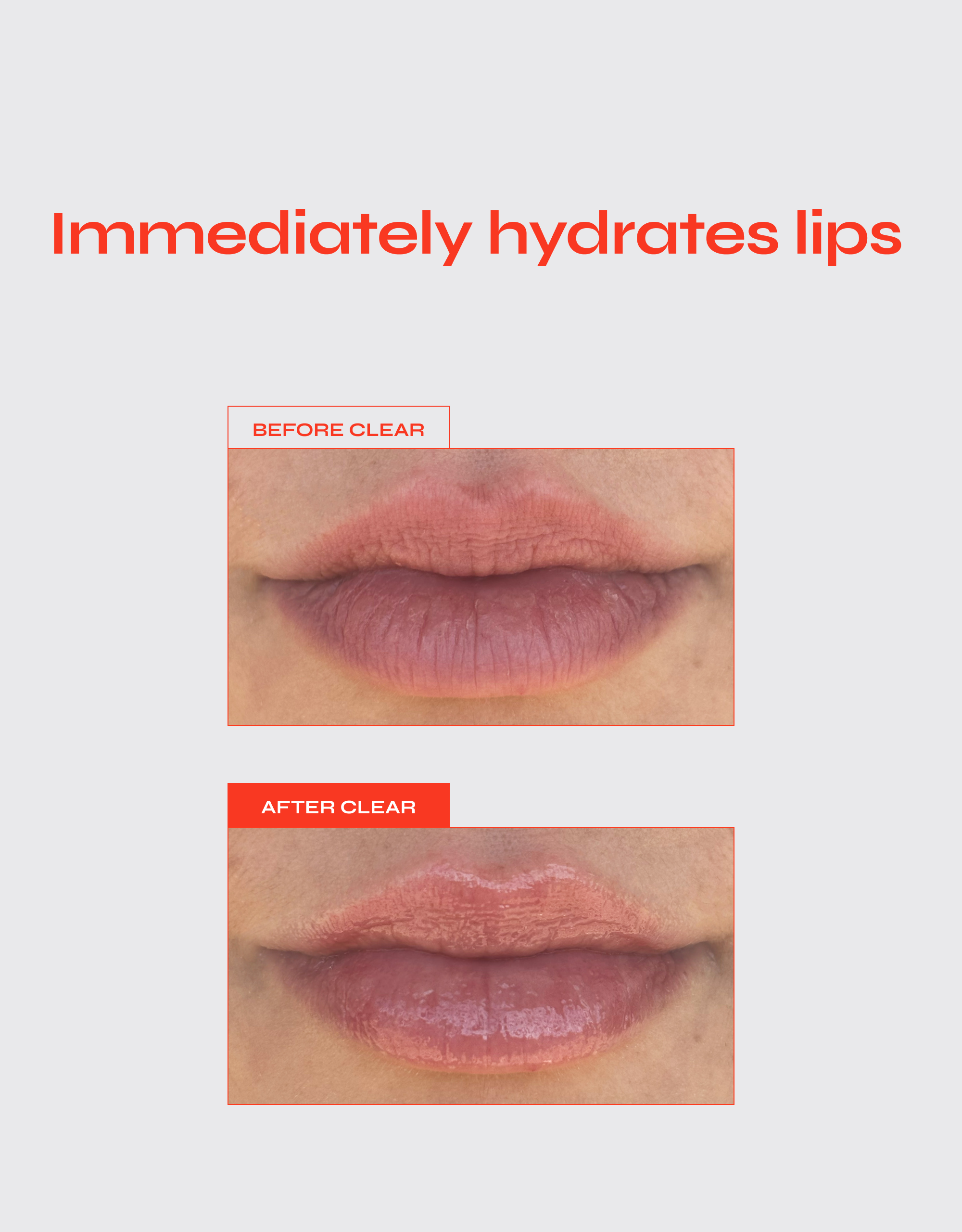 Lip Jelly Hydrating Peptide Lip Treatment with Squalane and Vitamin E