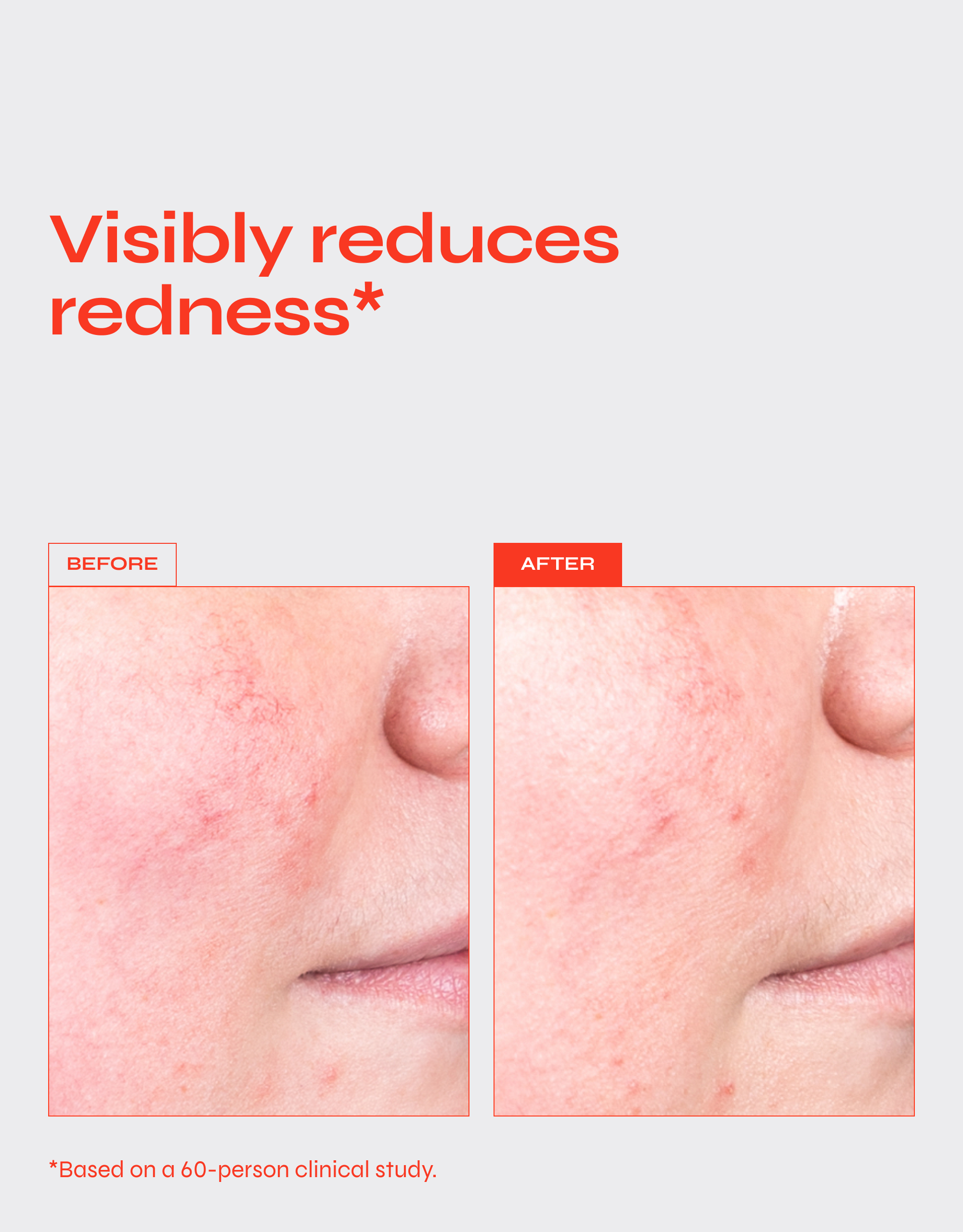 Destress Redness Calming Barrier Serum with Ceramides, Niacinamide and Vitamin C
