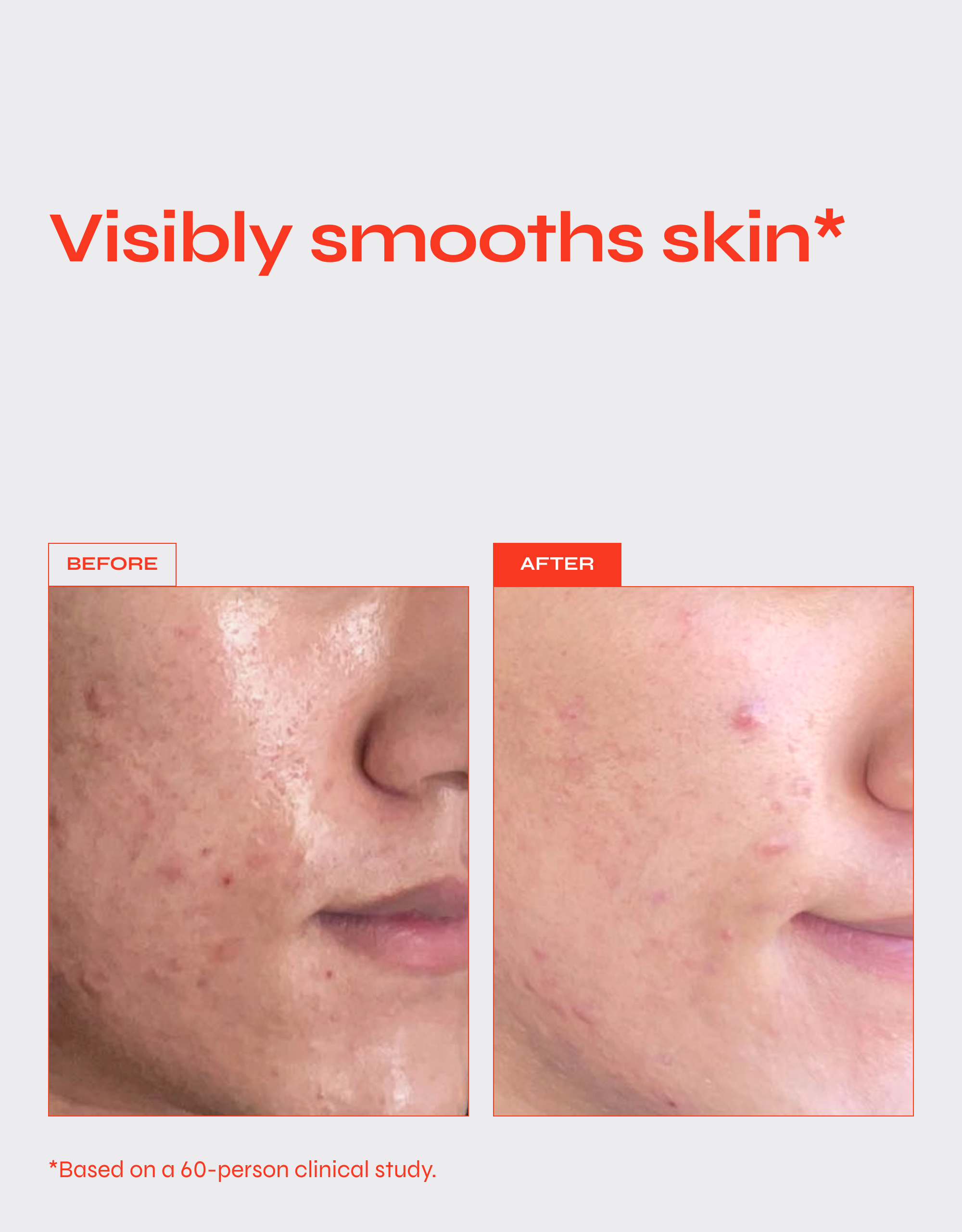 Reverse Anti-Aging Firming Serum with Encapsulated Retinol and Niacinamide