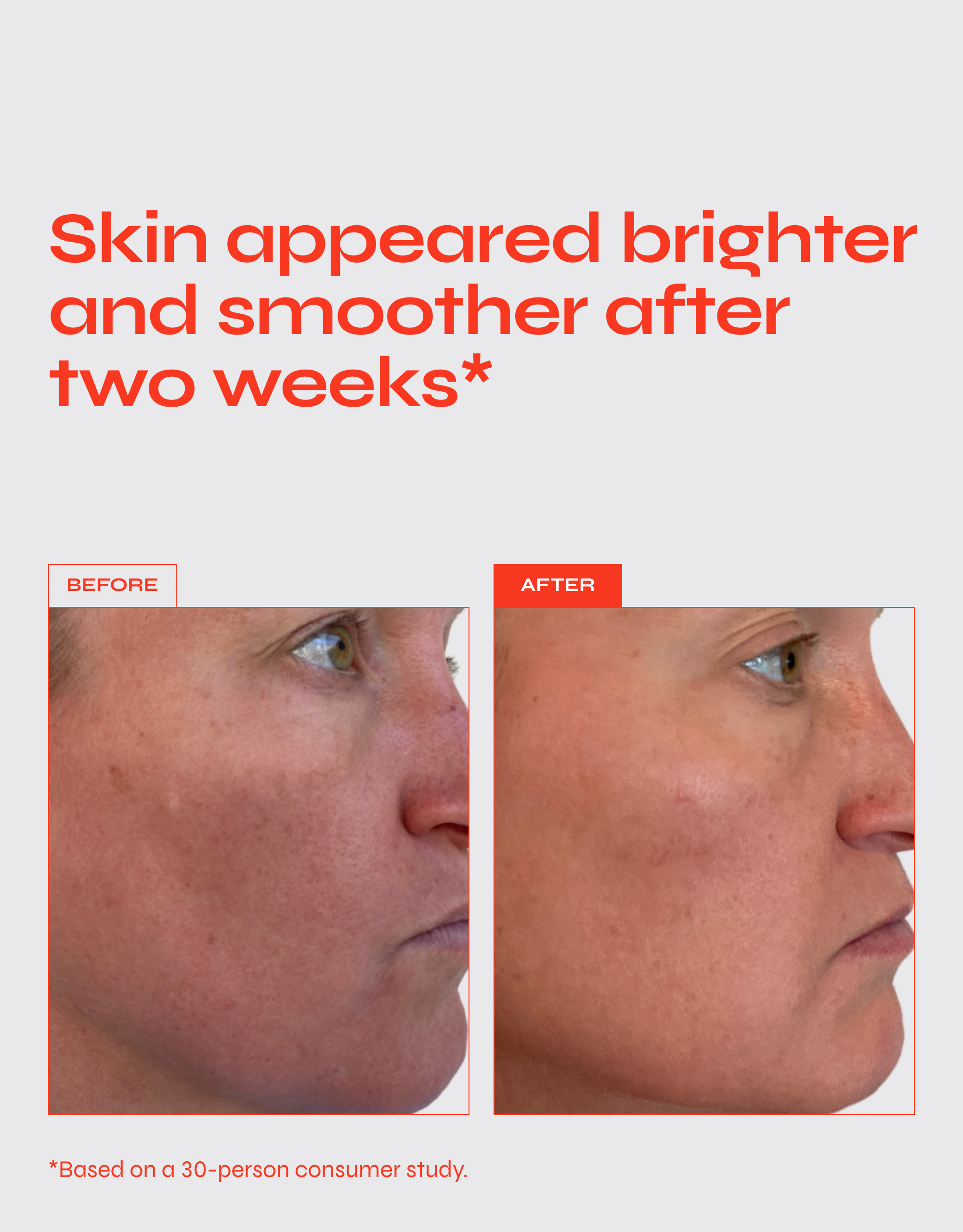The Buzz Brightening Exfoliating Treatment with Glycolic, Lactic, and Salicylic Acids
