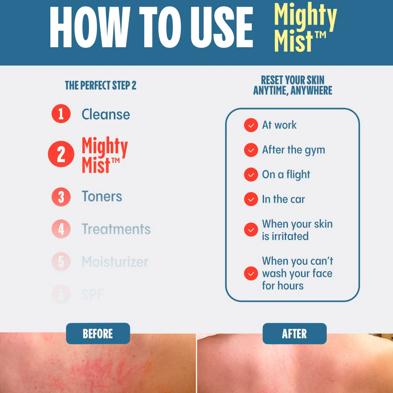 Instructional chart on how to use Mighty Mist skincare product with 'Before' and 'After' skin comparison.